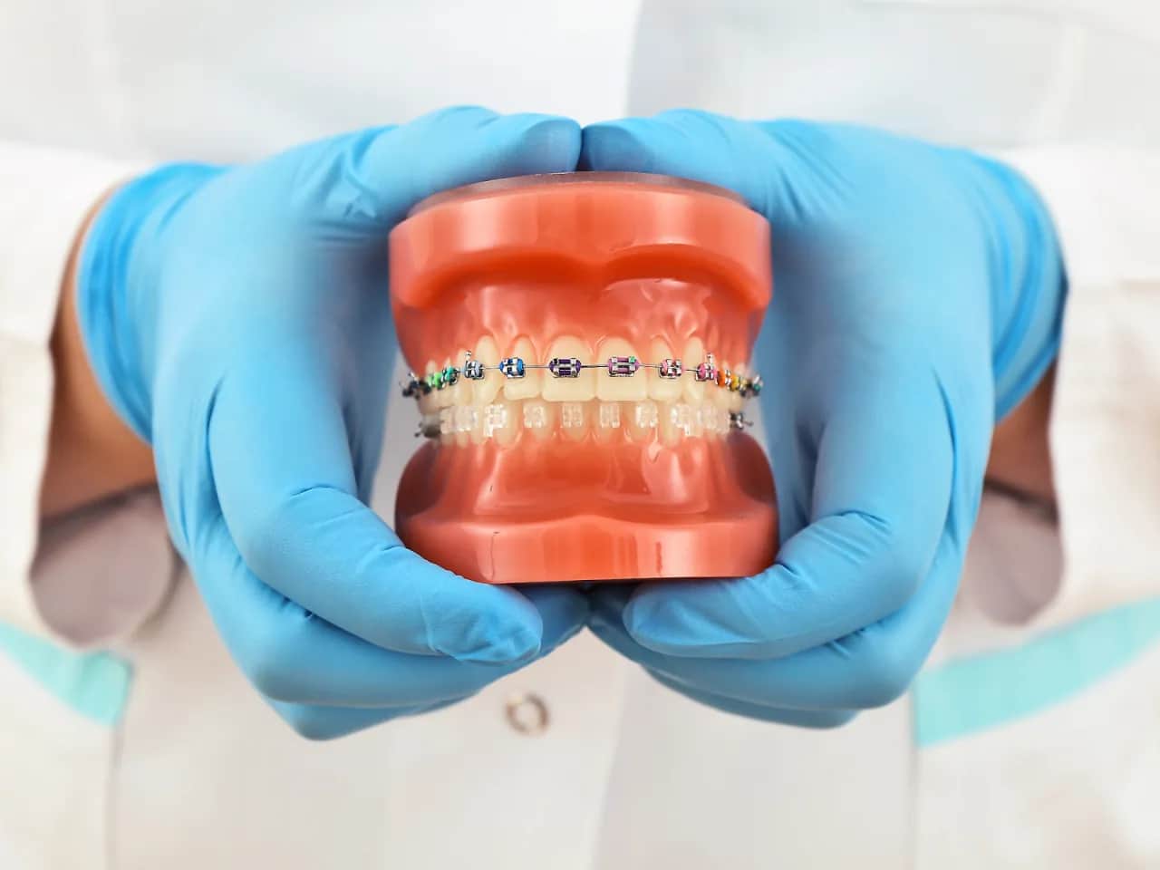 Chcesz aparat na zęby? Proces, koszty i typy pełny przewodnik.