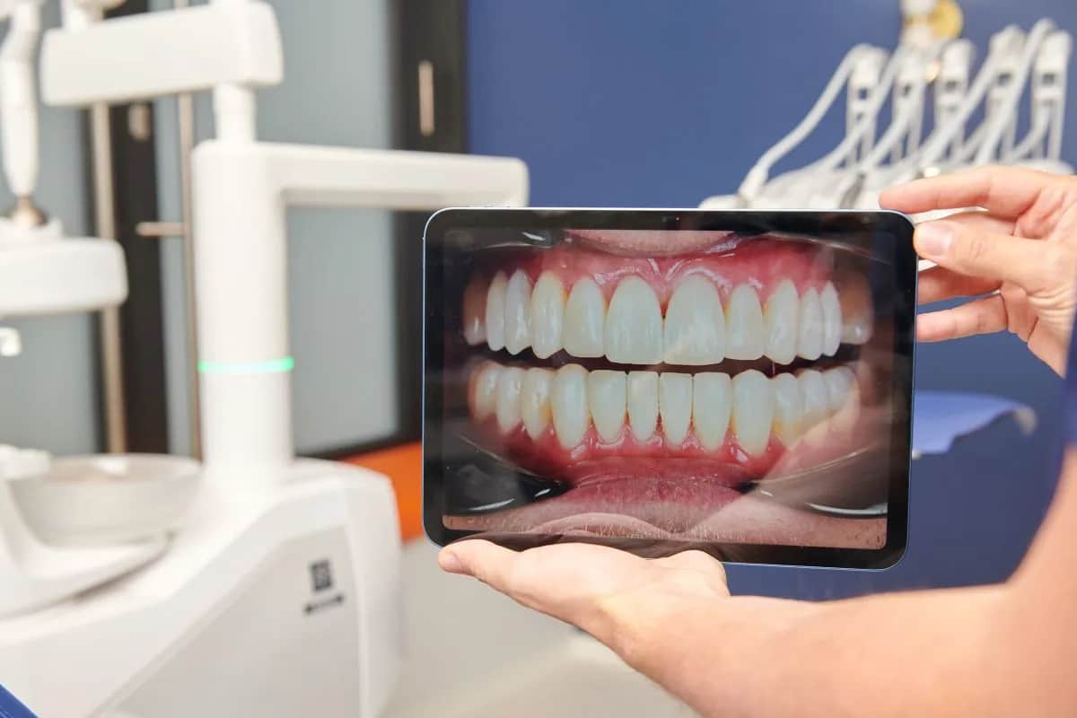 Jak prawidłowo myć zęby? Unikaj błędów i dbaj o zdrowie!