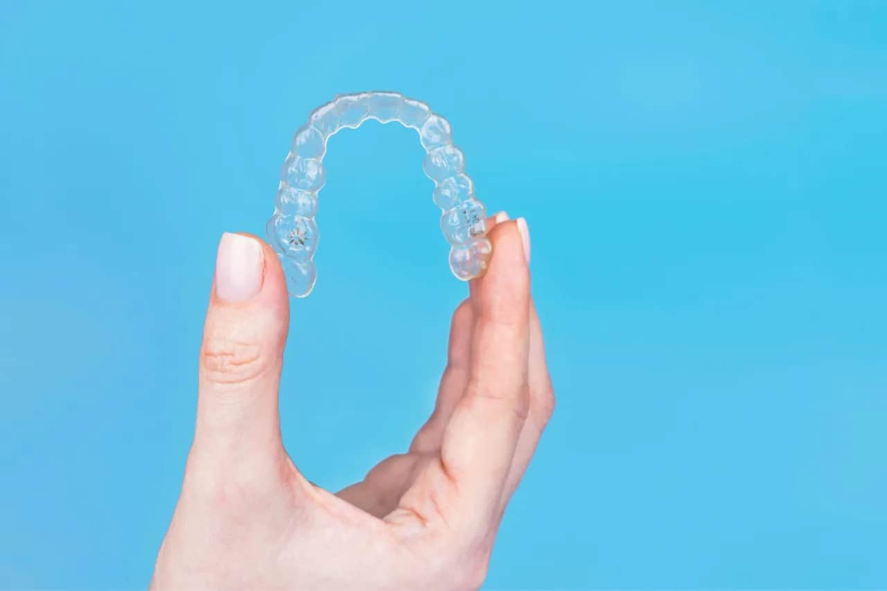 Nakładki retencyjne: Ile kosztują i dlaczego są kluczowe po aparacie?